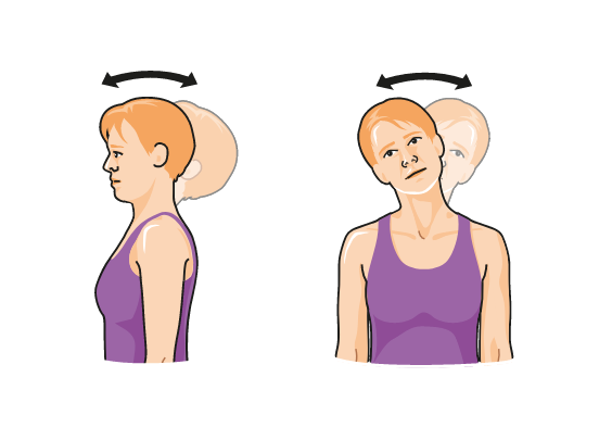 polyarthrite rhumatoïde